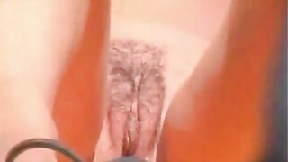 Hairy Teen Nude on Beach By TROC